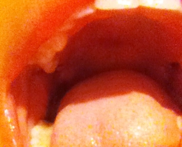 My right side of mouth